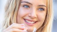 Spark™ Clear Aligners